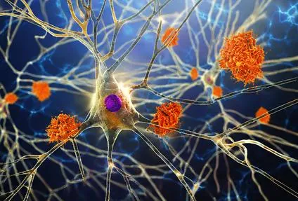Illustration of connected nerve cells with orange clusters